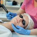 Laser Fotona SMOOTH® pour les cernes