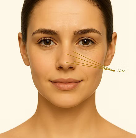 Médecine esthétique du nez à Garches chez le dr Herz