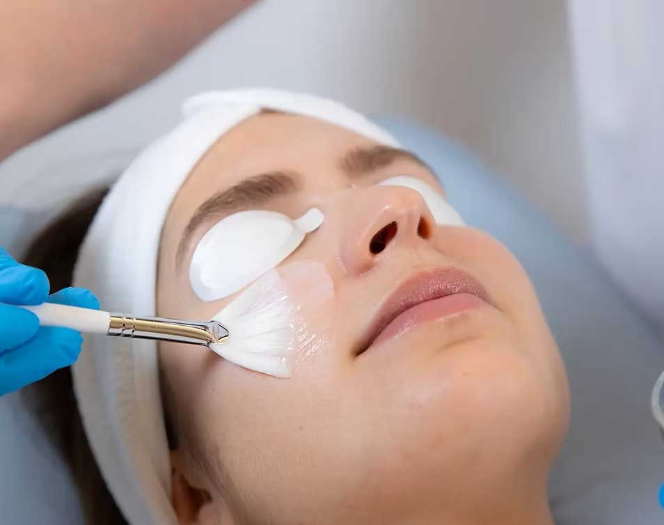 Peeling du visage à Garches